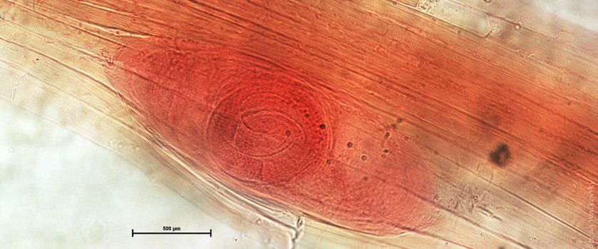 1024px-trichinella_spiralis